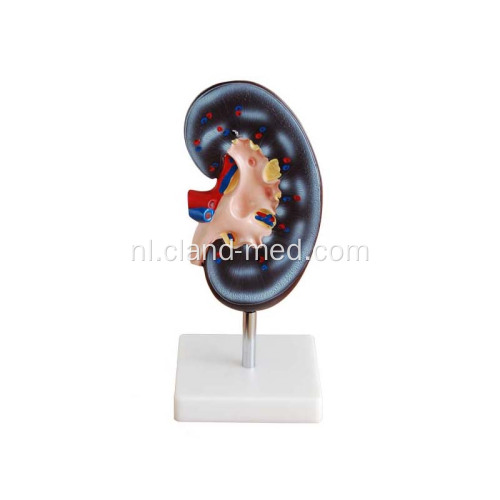 Medical Kidney Model 1 Part